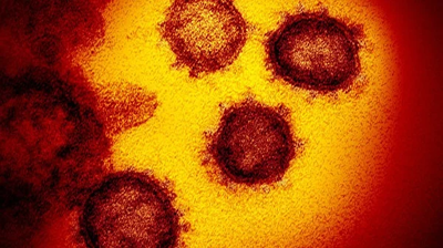 电子显微镜下的中共病毒。(图片来源:NIAID洛矶山实验室)。